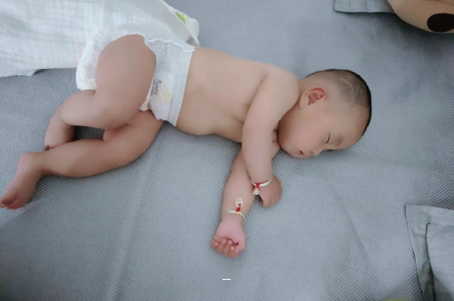 宜阳宝宝脸上有白色斑块